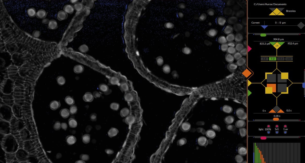 Aurox Visionary Imaging