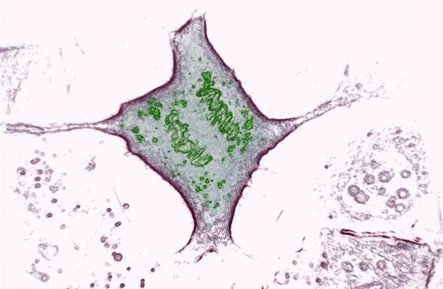 Mitosis