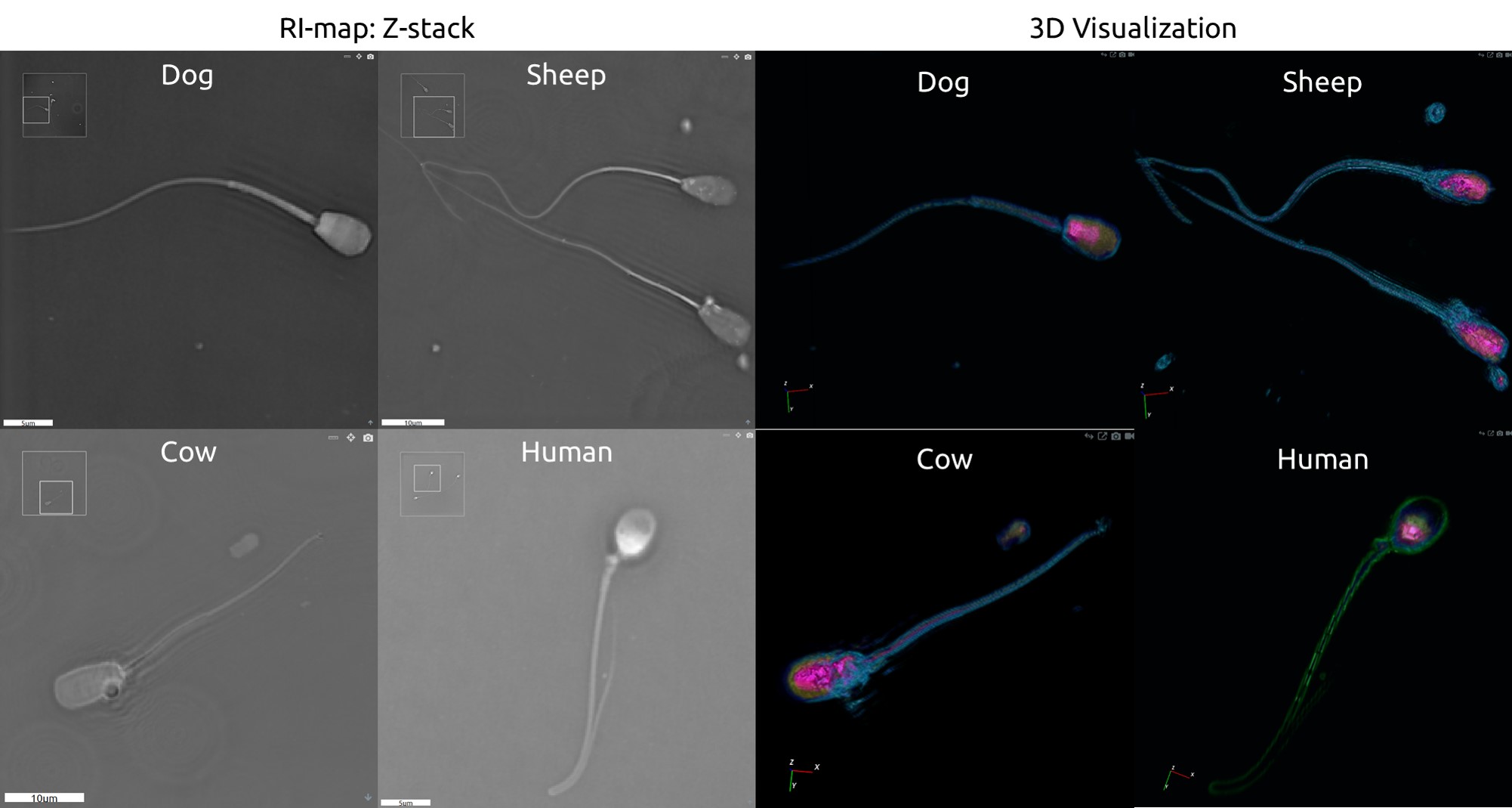 Sperm Cell Comparison