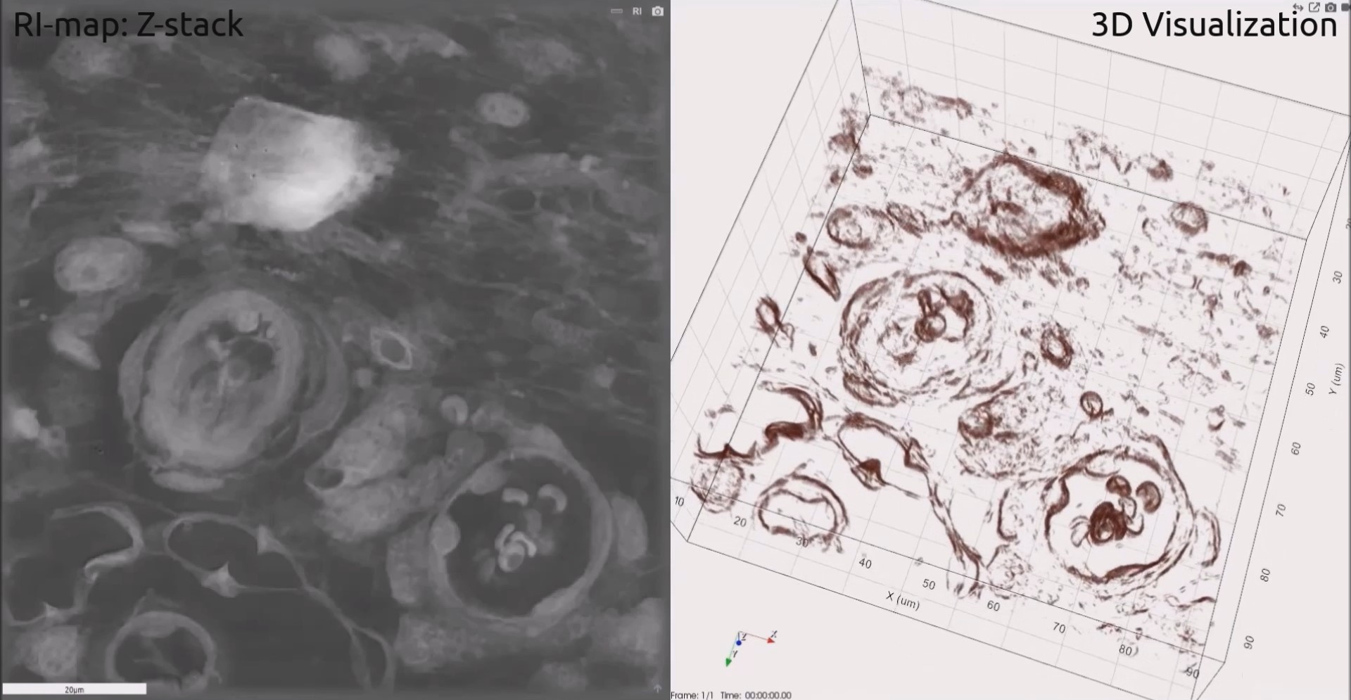 Refractive Index Map of Z‐stack, and 3‐D Visualization of Tissue