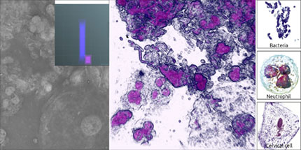 Cytology and Cytopathology