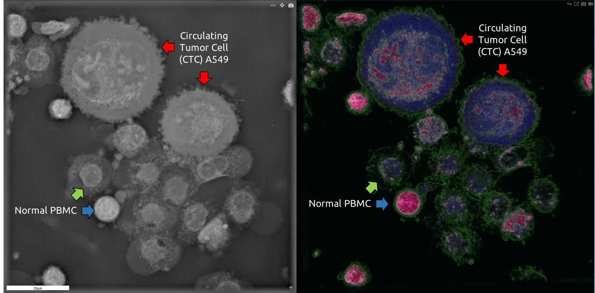 Detection Circulating Tumor Cells