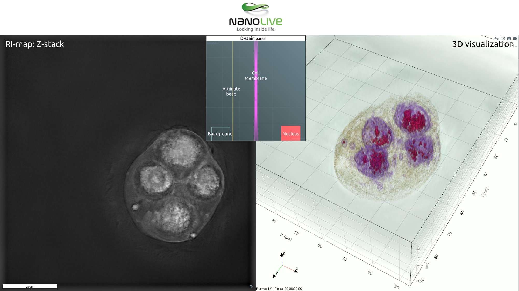 Arginate Bead with Cells