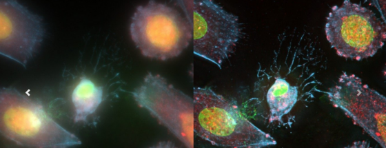 Microvolution example: Human osteosarcoma cell line Saos‐2