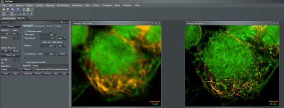 Image overlay with DNA staining in green and Microtubule staining in orange